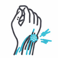 肌腱炎／過度使用症候群 icon